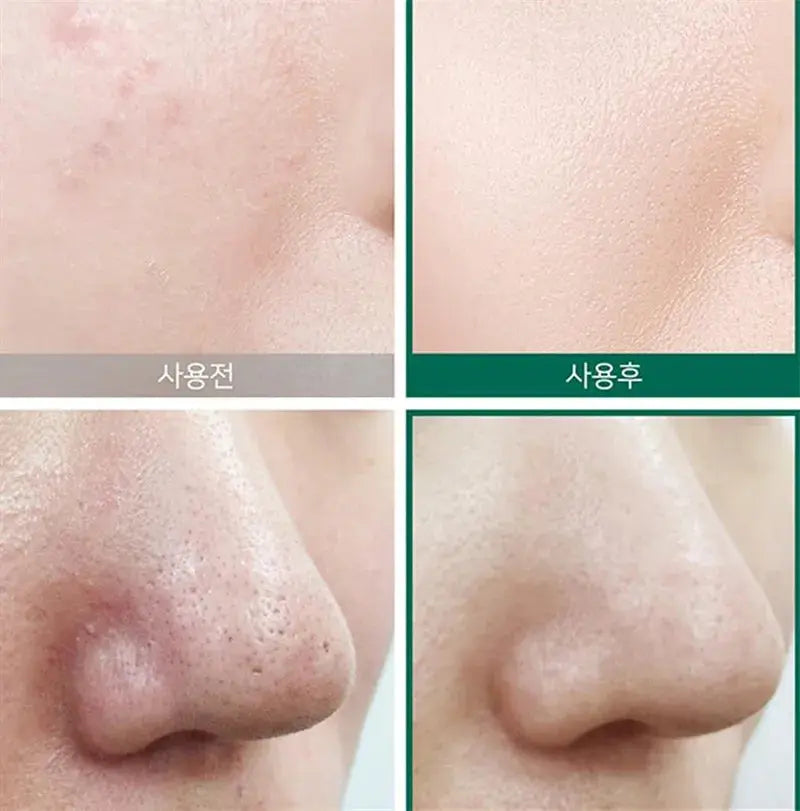 Toner Miracle - Some By MiAHA BHA PHA - Korean Beauty & Healthy