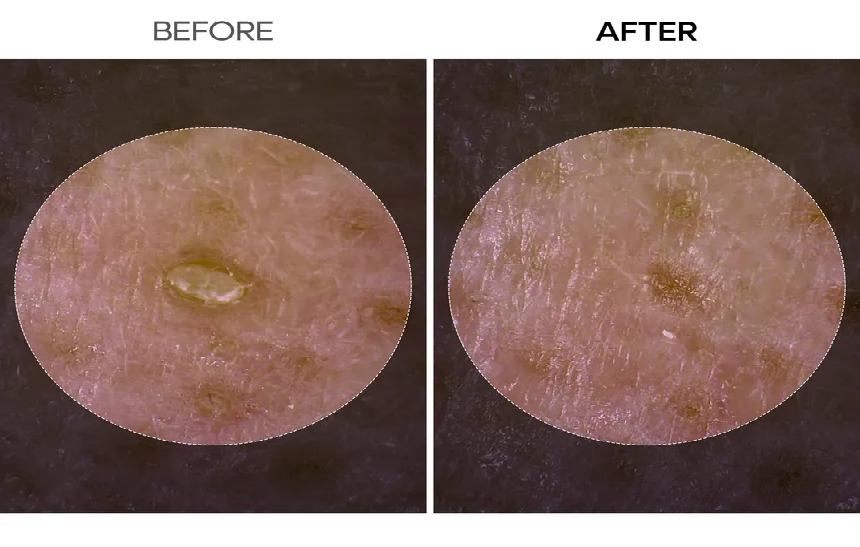 Dr.Melaxin Peel Shot Exfoliant Rice Ampoule My Korean BeautyKorean skincare Glow up