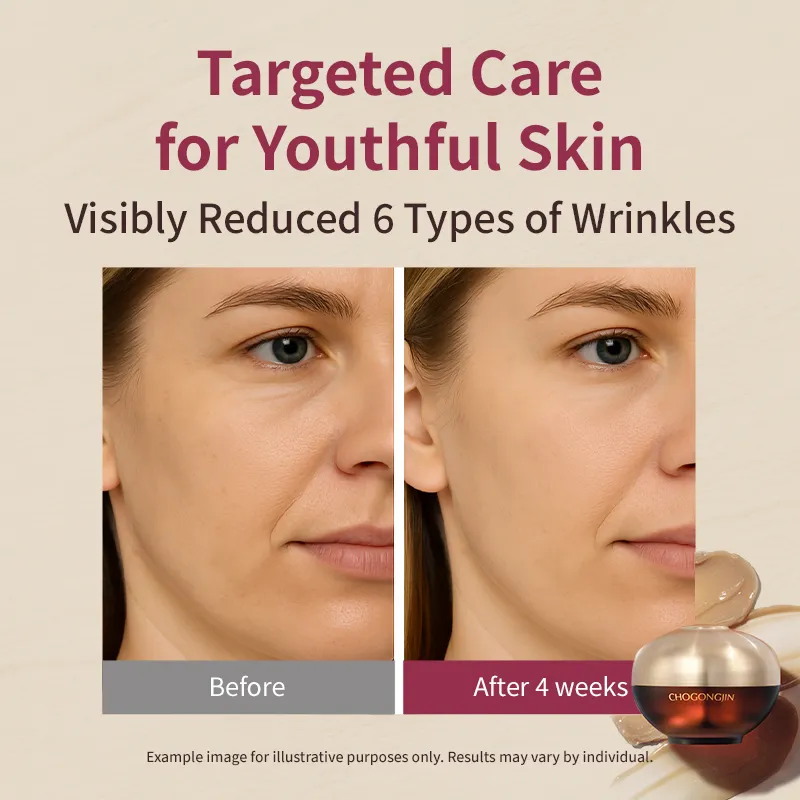 MISSHA - Chogongjin Youngan Lifting Set My Korean BeautyKorean skincare Glow up