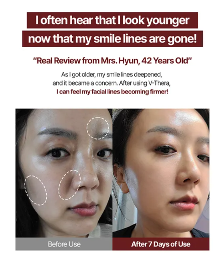 mommy care - EMS V-THERA Pink Edition Korean Beauty & Healthy LTDKorean skincare Glow up
