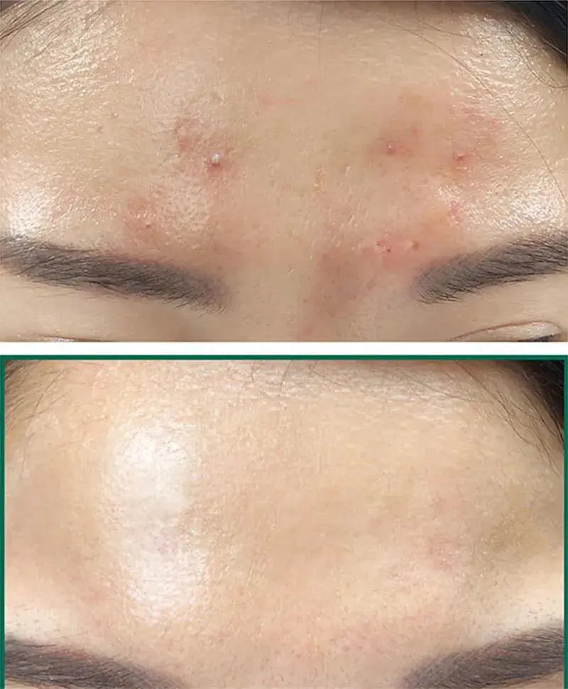 Toner Miracle - Some By MiAHA BHA PHA - Korean Beauty & Healthy