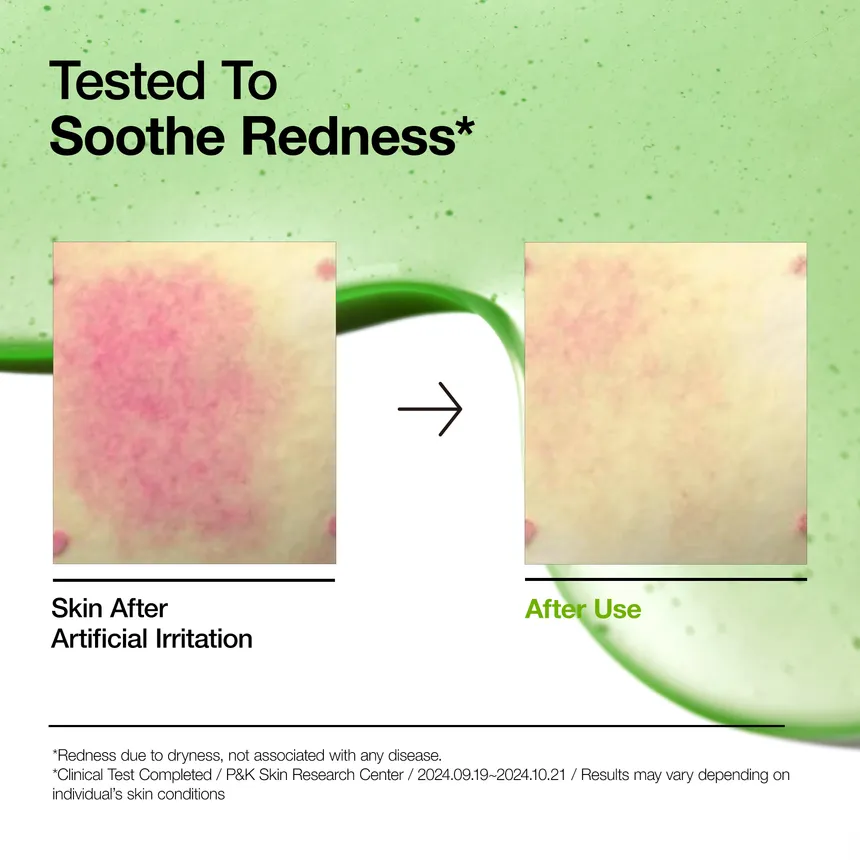 Anua Azelaic Acid 10 Hyaluron Redness Soothing Serum My Korean BeautyKorean skincare Glow up
